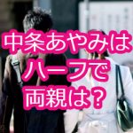 中条あやみはハーフで両親は？CMで足太くて身長についても
